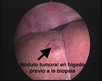 CIRUGIA ABDOMINAL Y LAPAROSCOPIA CIRUGIA ABDOMINAL Y LAPAROSCOPIA