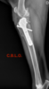 ROTURA LIGAMENTO CRUZADO ANTERIOR ROTURA LIGAMENTO CRUZADO ANTERIOR
