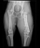 fractura femoral multifragmentada en un bóxer de 4 años reparada con placa y tornillos, agujas de Kirschner, clavo intra medular y cerclajes